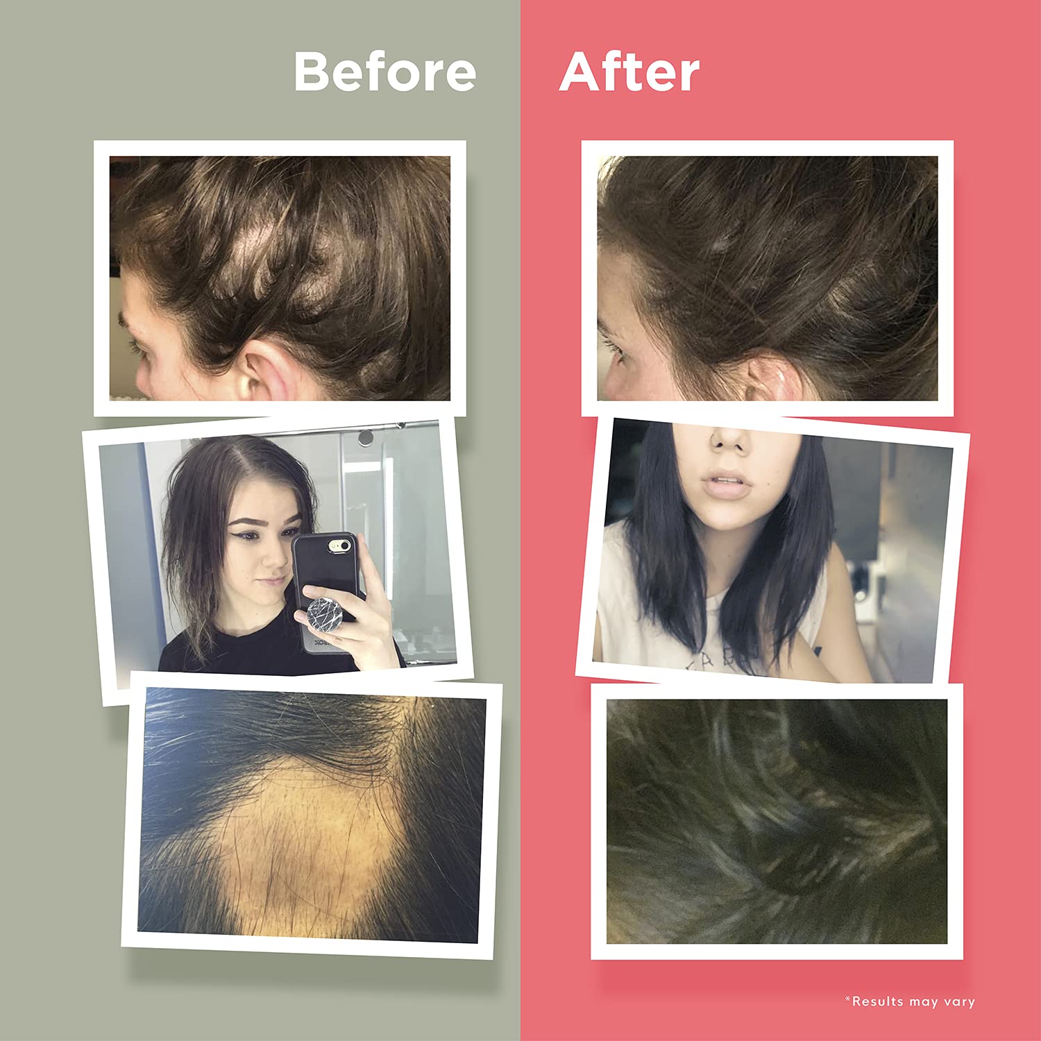Naturenetics HairAnew Hair Growth Vitamins for Women & Men - Hair Vitamins For Faster Hair Growth & Thickness - Part of Proceeds go to Hair Loss Charity - Vegan Hair Supplement For Hair Skin Nails (1)